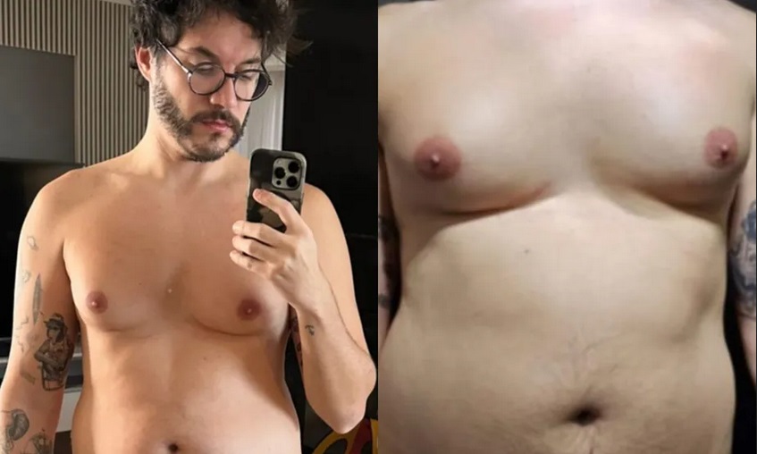 Eliezer descobre doença na mama por ‘desequilíbrio hormonal’