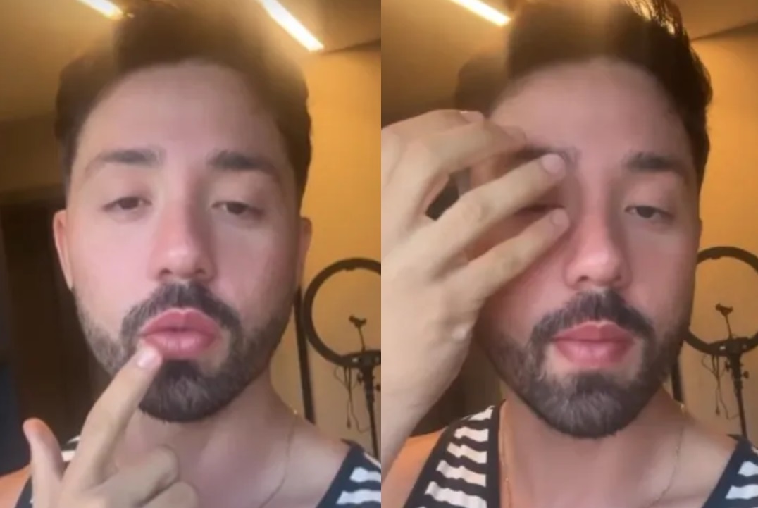 Rico Melquiades se afasta das redes sociais após diagnóstico de paralisia facial