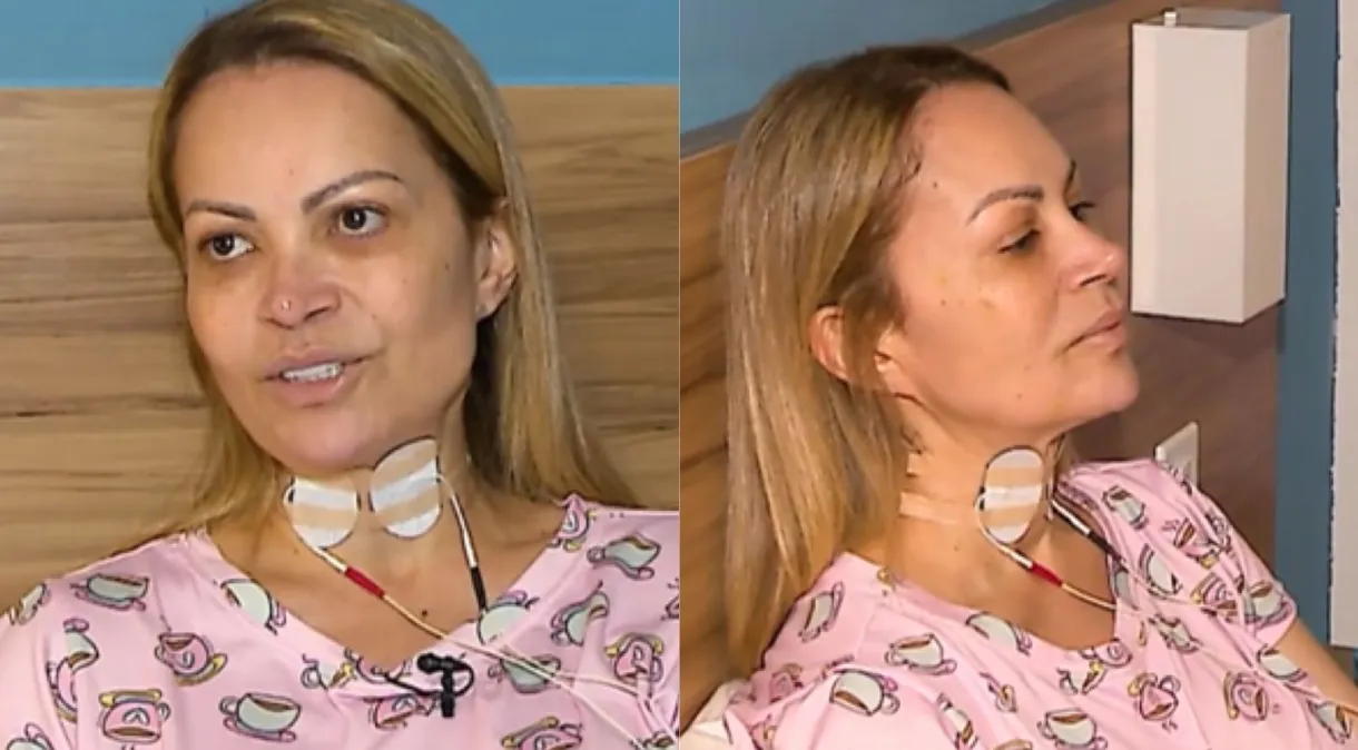 Simone Almeida sofreu lesões por conta de vape