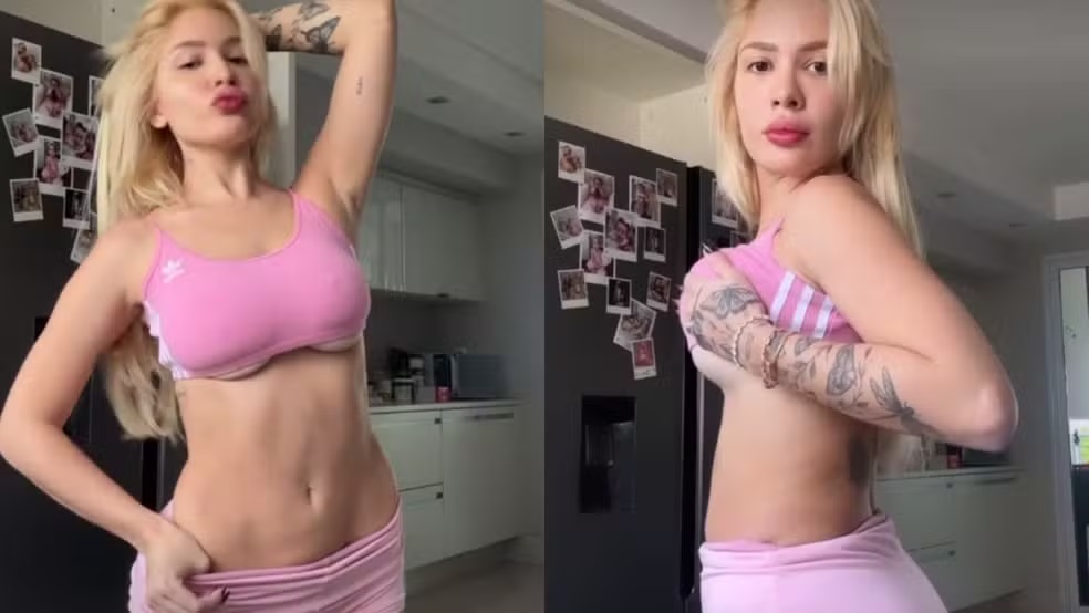 Karoline Lima abre o jogo sobre cirurgias