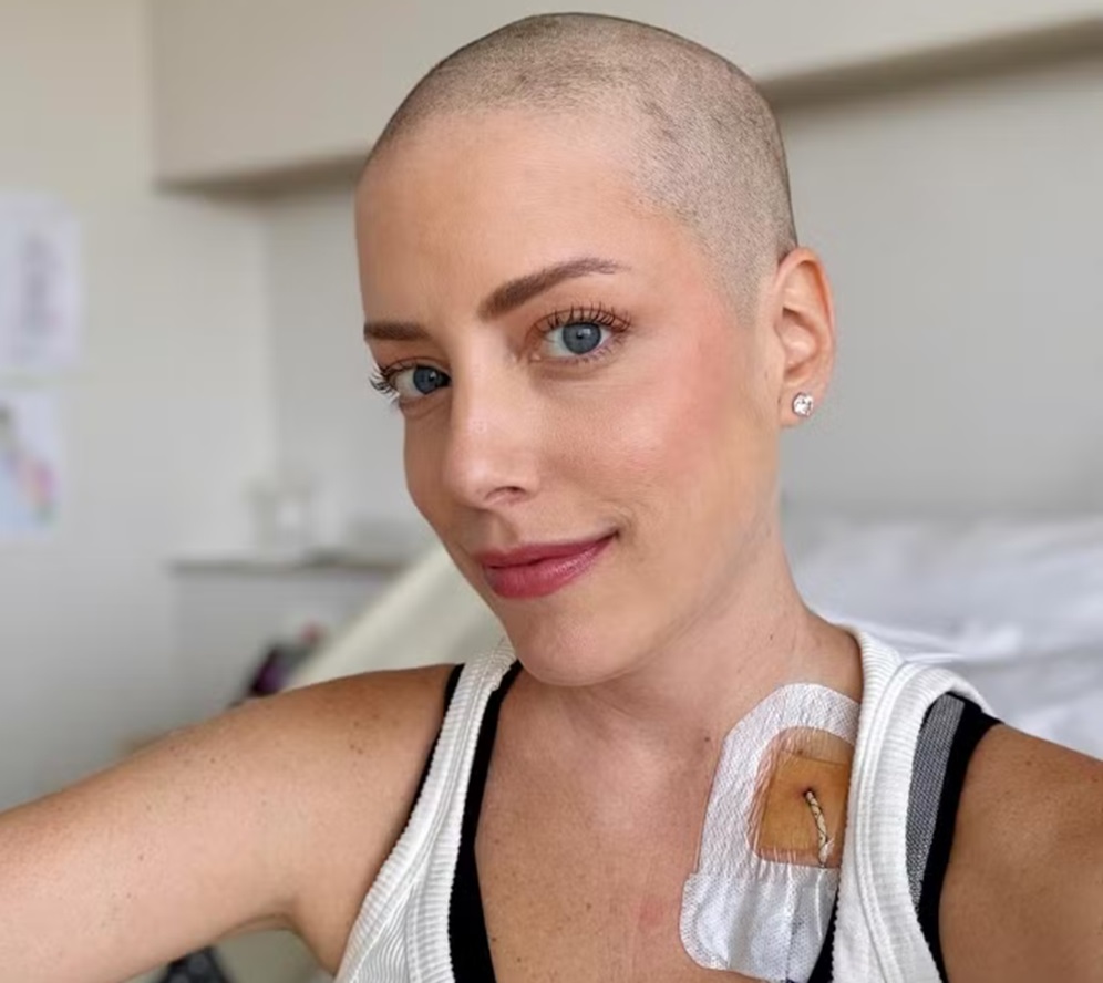 Fabiana Justus raspa o cabelo em meio a tratamento contra a leucemia